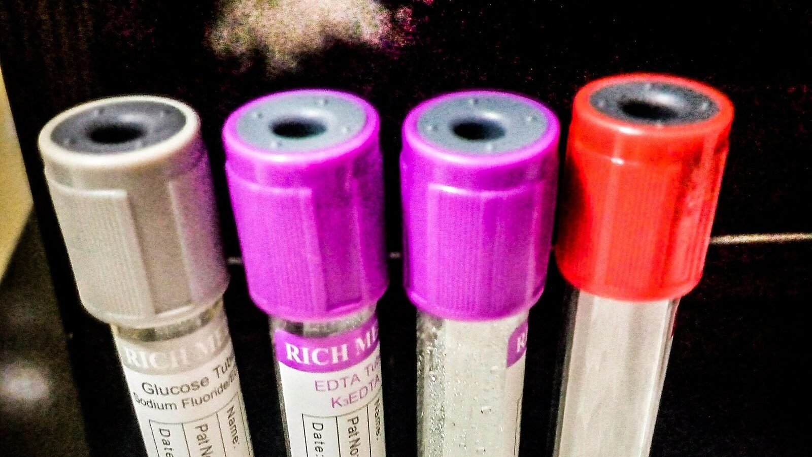 Recurrent UTI: Causes and Prevention