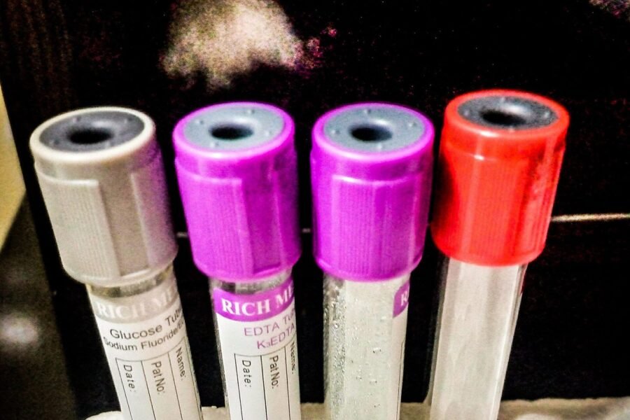 Recurrent UTI: Causes and Prevention