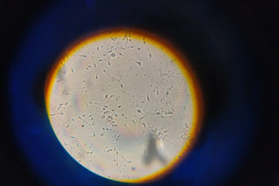 Male Infertility: Common Causes